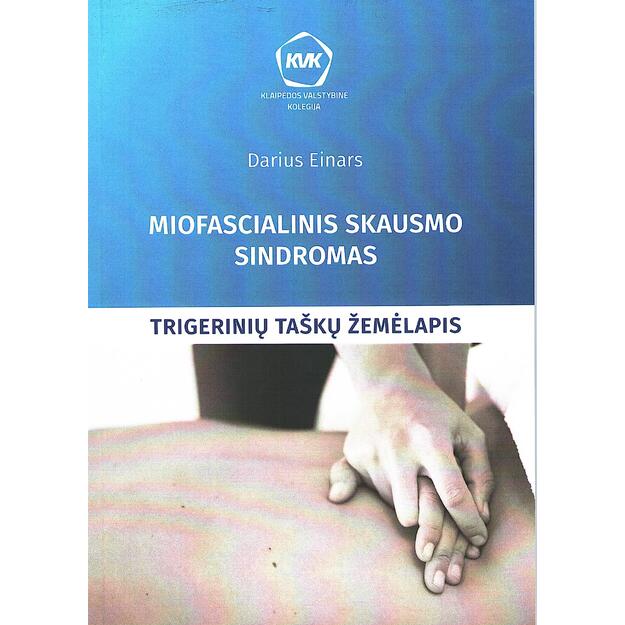 Miofascialinis skausmo sindromas: trigerinių taškų žemėlapis