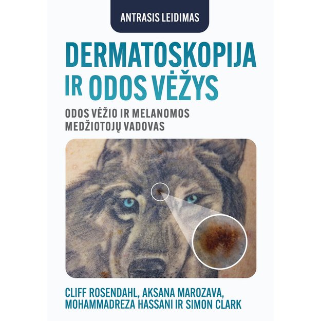 DERMATOSKOPIJA IR ODOS VĖŽYS