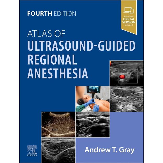Atlas of Ultrasound-Guided Regional Anesthesia 4th edition