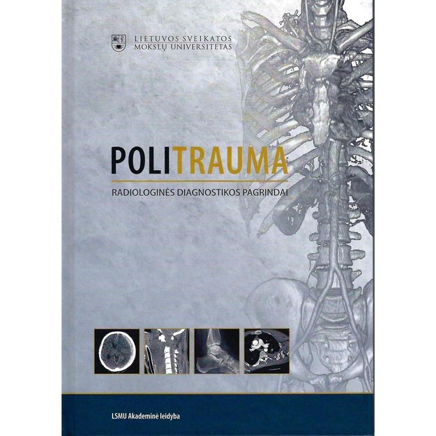 Politrauma. Radiologinės diagnostikos pagrindai 