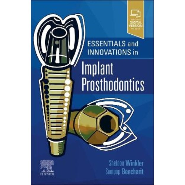 Essentials and Innovations in Implant Prosthodontics 