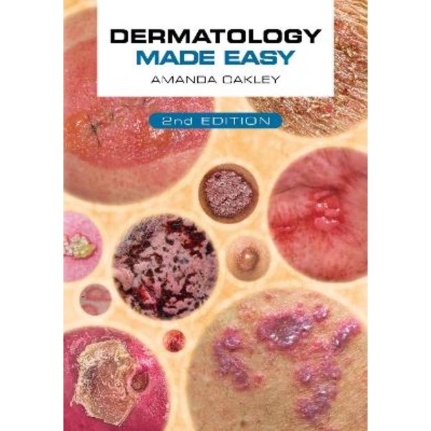 Dermatology Made Easy 2nd Revised edition