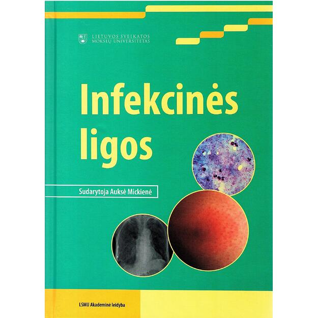 Infekcinės ligos