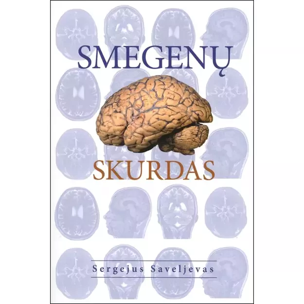 Smegenų skurdas