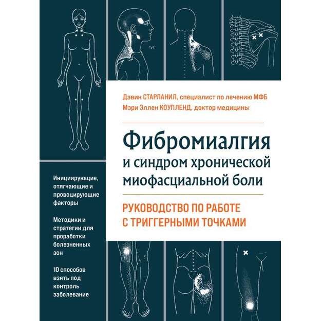 Фибромиалгия и синдром хронической миофасциальной боли. Руководство по работе с триггерными точками 