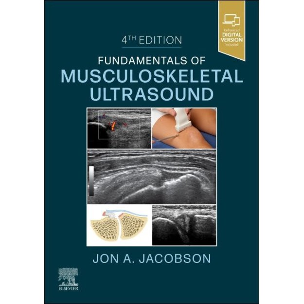 Fundamentals of Musculoskeletal Ultrasound 4th edition