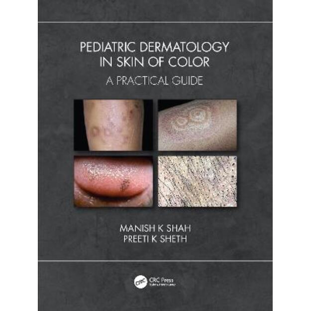 Pediatric Dermatology in Skin of Color: A Practical Guide
