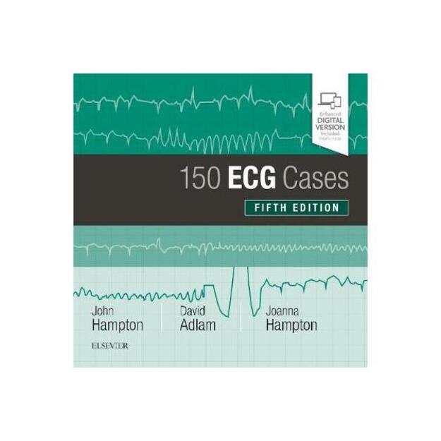150 ECG Cases 5th Revised edition 