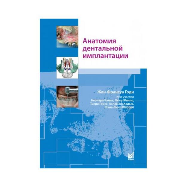 Анатомия дентальной имплантации  1-е издание Перевод франц.