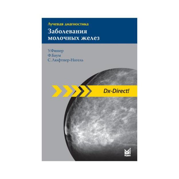 Лучевая диагностика. Заболевания молочных желез 2-е изд.Перевод с английского