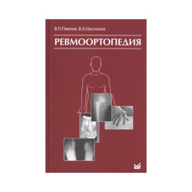 Ревмоортопедия. 2-е издание.