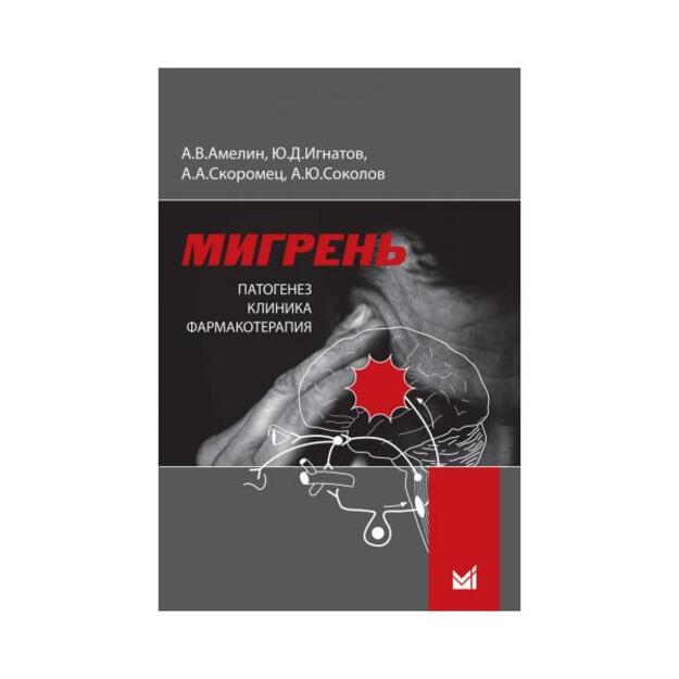 Мигрень