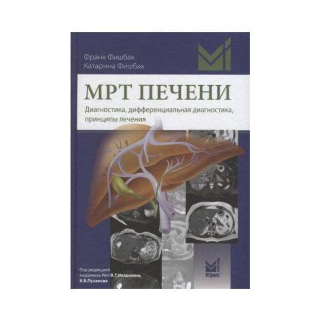 МРТ печени. Диагностика дифференциальная диагностика принципы лечения. Перевод с немецкого