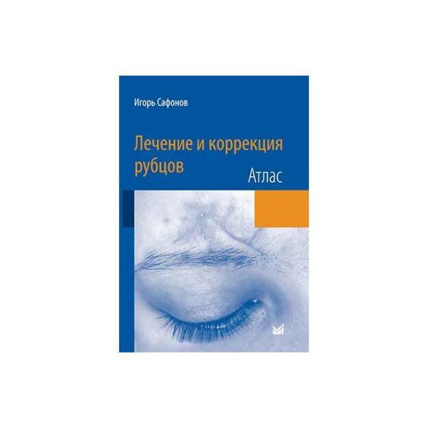 Лечение и коррекция рубцов. Атлас. Перевод  с  английского