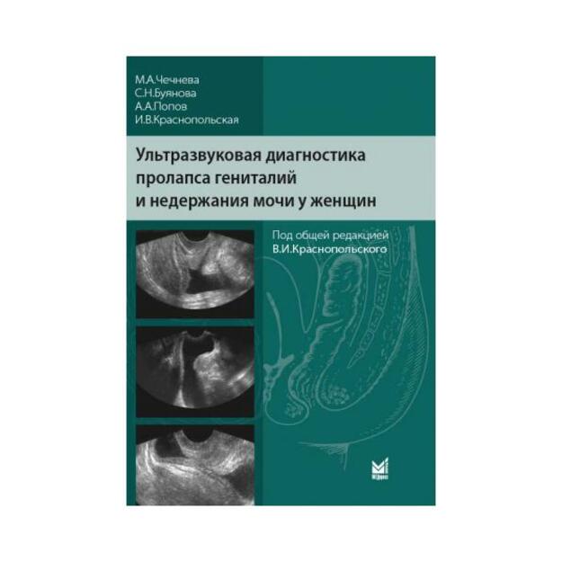 Ультразвуковая диагностика пролапса гениталий и недержания мочи у женщин