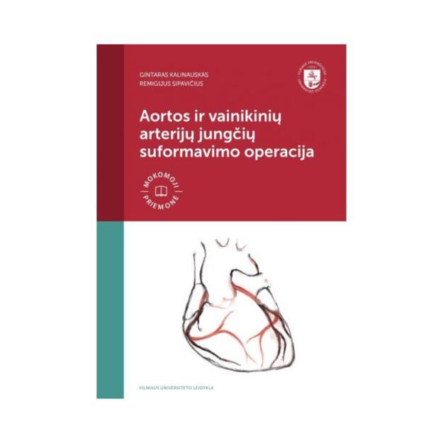 Aortos ir vainikinių arterijų jungčių suformavimo operacija
