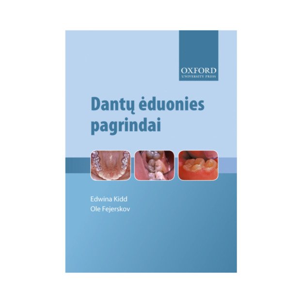 Dantų ėduonies pagrindai. Ketvirtasis leidimas. Versta iš anglų kalbos