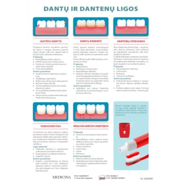  Dantų ir dantenų ligos. Plakatas