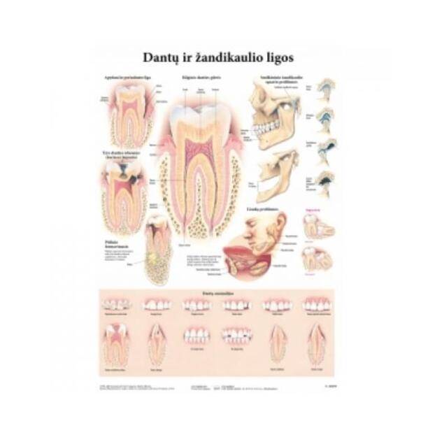  Dantų ir žandikaulio ligos. Plakatas