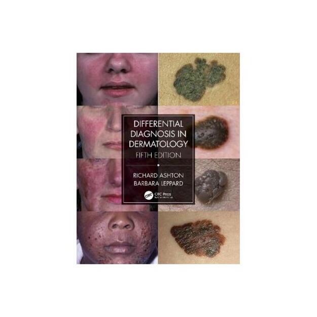 Differential Diagnosis in Dermatology 5th New edition