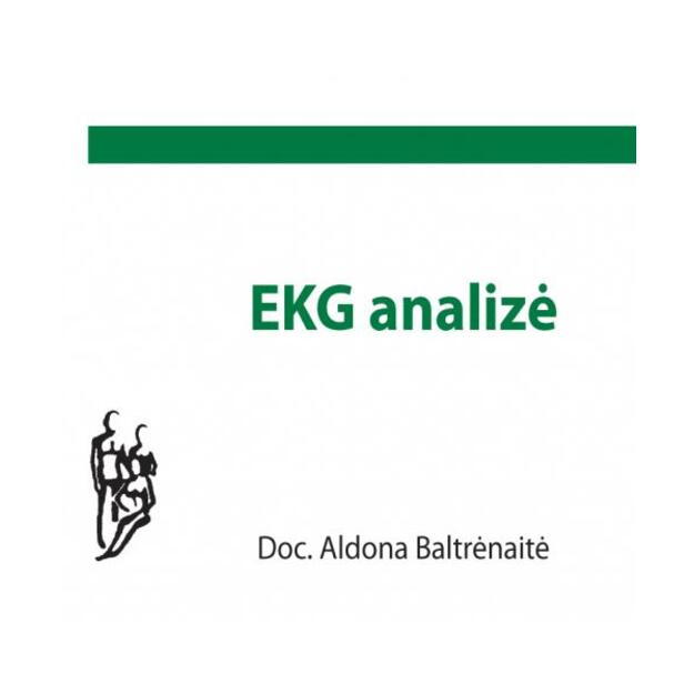 EKG analizė