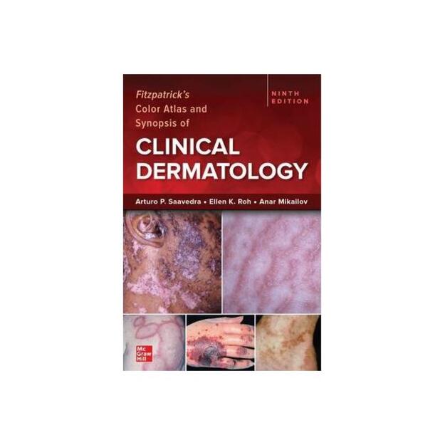 Fitzpatrick's Color Atlas and Synopsis of Clinical Dermatology 9th edition