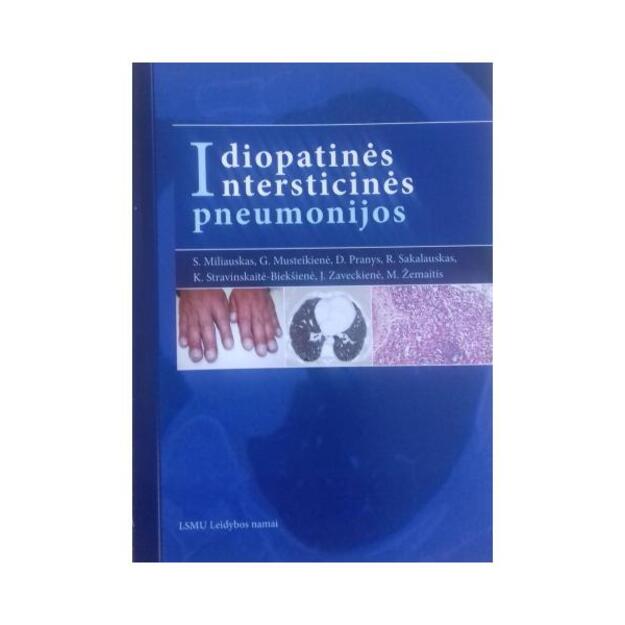 Idiopatinės intersticinės pneumonijos. Mokomoji knyga.