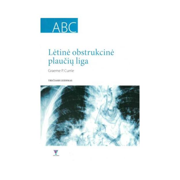 Lėtinė obstrukcinė plaučių liga ABC. Trečiasis leidimas.