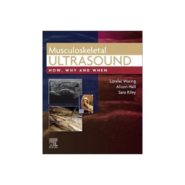 Musculoskeletal Ultrasound: How, Why and When 
