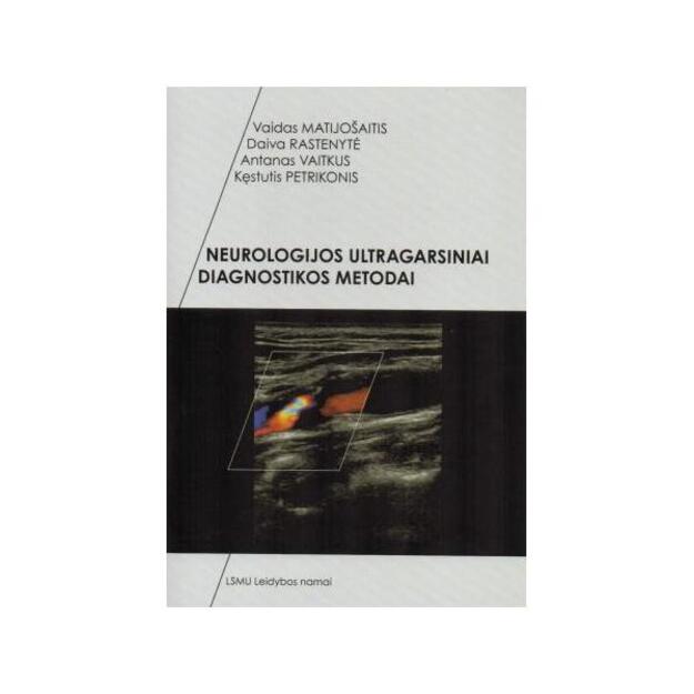 Neurologijos ultragarsiniai diagnostikos metodai