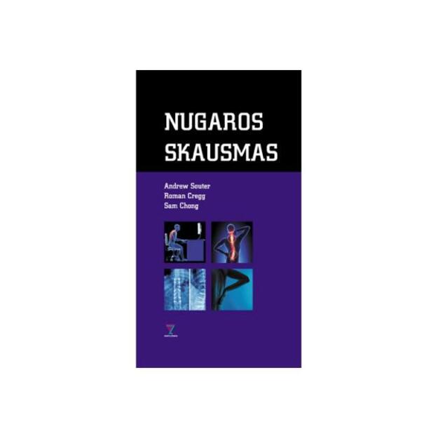 Nugaros skausmas