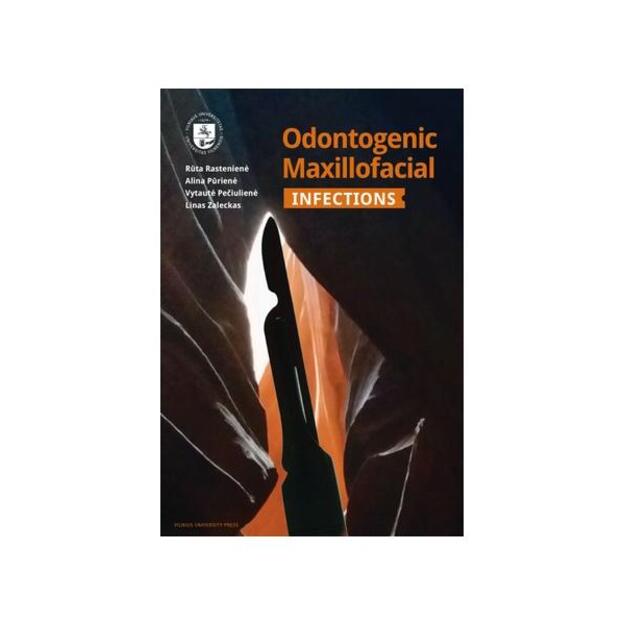  Odontogenic Maxillofacial Infections