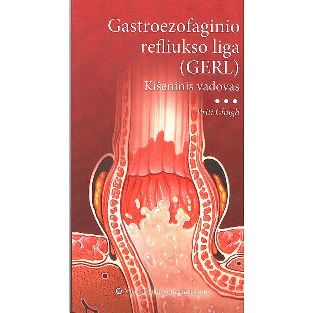 Gastroezofaginio refliukso liga Kišeninis vadovas